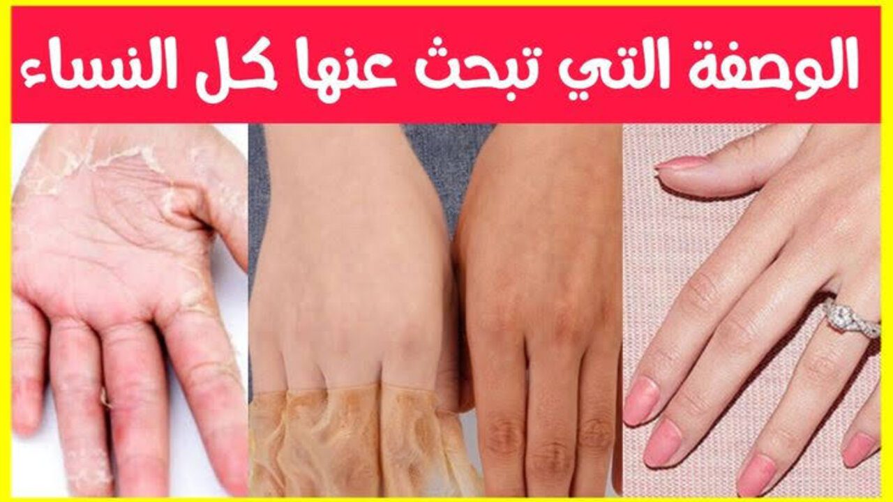 أهم علامات جمال المرأة.. خلطة طبيعية لتفتيح اليدين والتخلص من السواد والاسمرار سريعاً