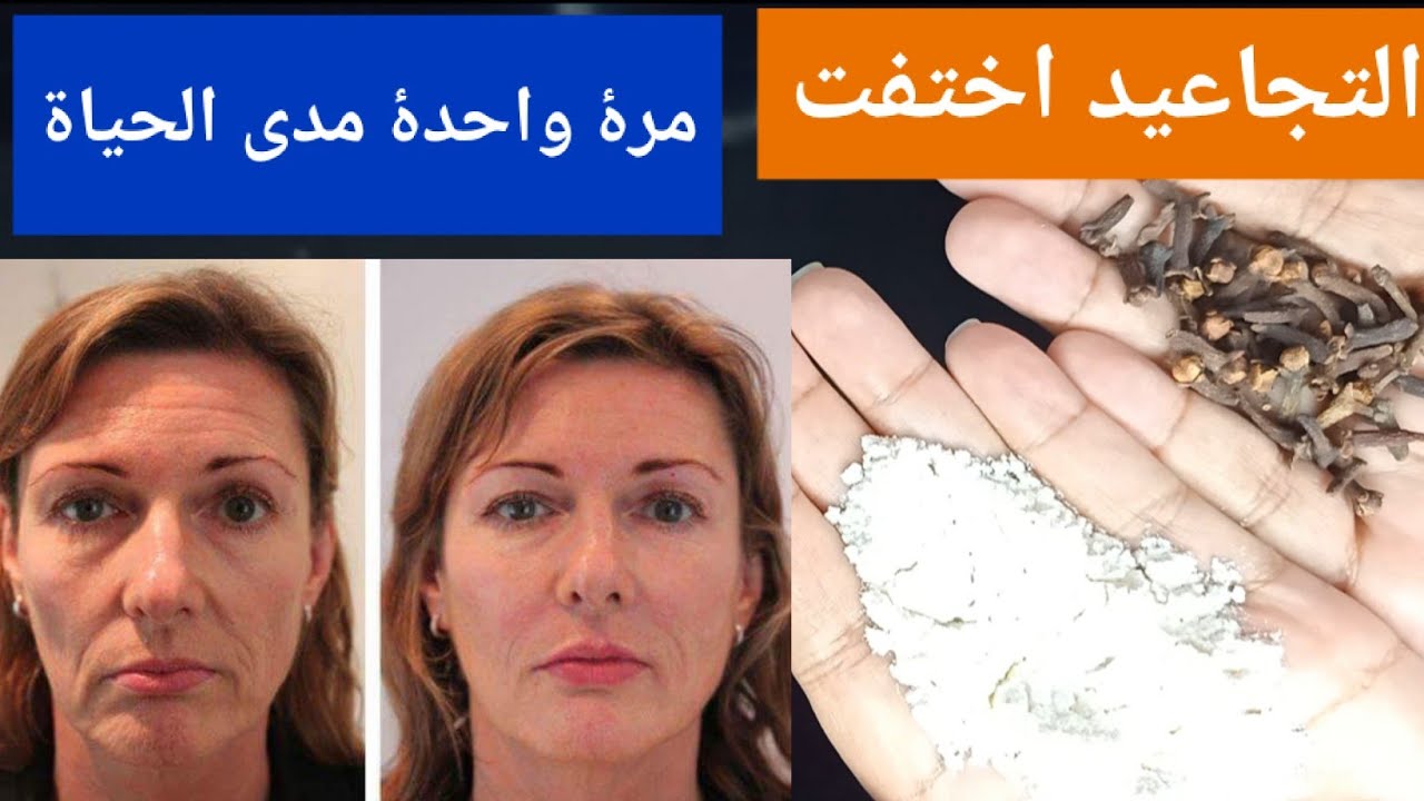 بشرتك هتبقى صافية زي القشطة.. وصفة القرنفل والنشا لتفتيح لون البشرة والجسم كله وتبيض فوري للمناطق الغامقة