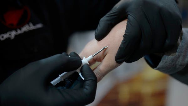 ساحر يفقد كلمة مرور شريحة زرعها داخل جسده لاستخدامها في الخدع