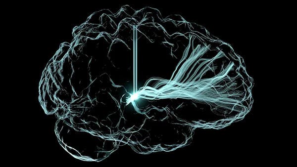 مصاب بالشلل يتحكم في روبوت بشريحة دماغية