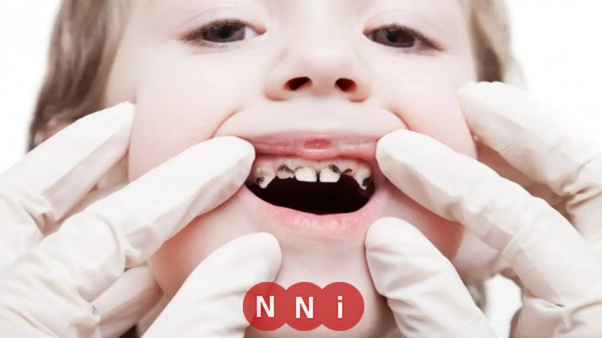 دليل الأمهات: اكتشفي العمر المثالي لأول زيارة لطفلك لطبيب الأسنان