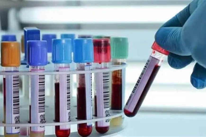 من بينهم “عز لاب”.. سيتي للتحاليل الطبية تخطط للاستحواذ على 5 شركات محلية