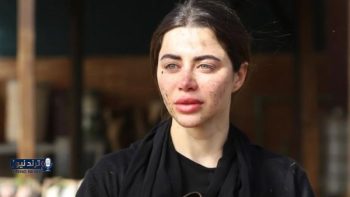 يارا السكري: تجسيد شخصية روح في “علي كلاي” كان تحدياً كبيراً والعمل مع العوضي كان مريحاً