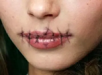 امرأة يابانية تخيط شفتي جارتها لمنعها من الكلام